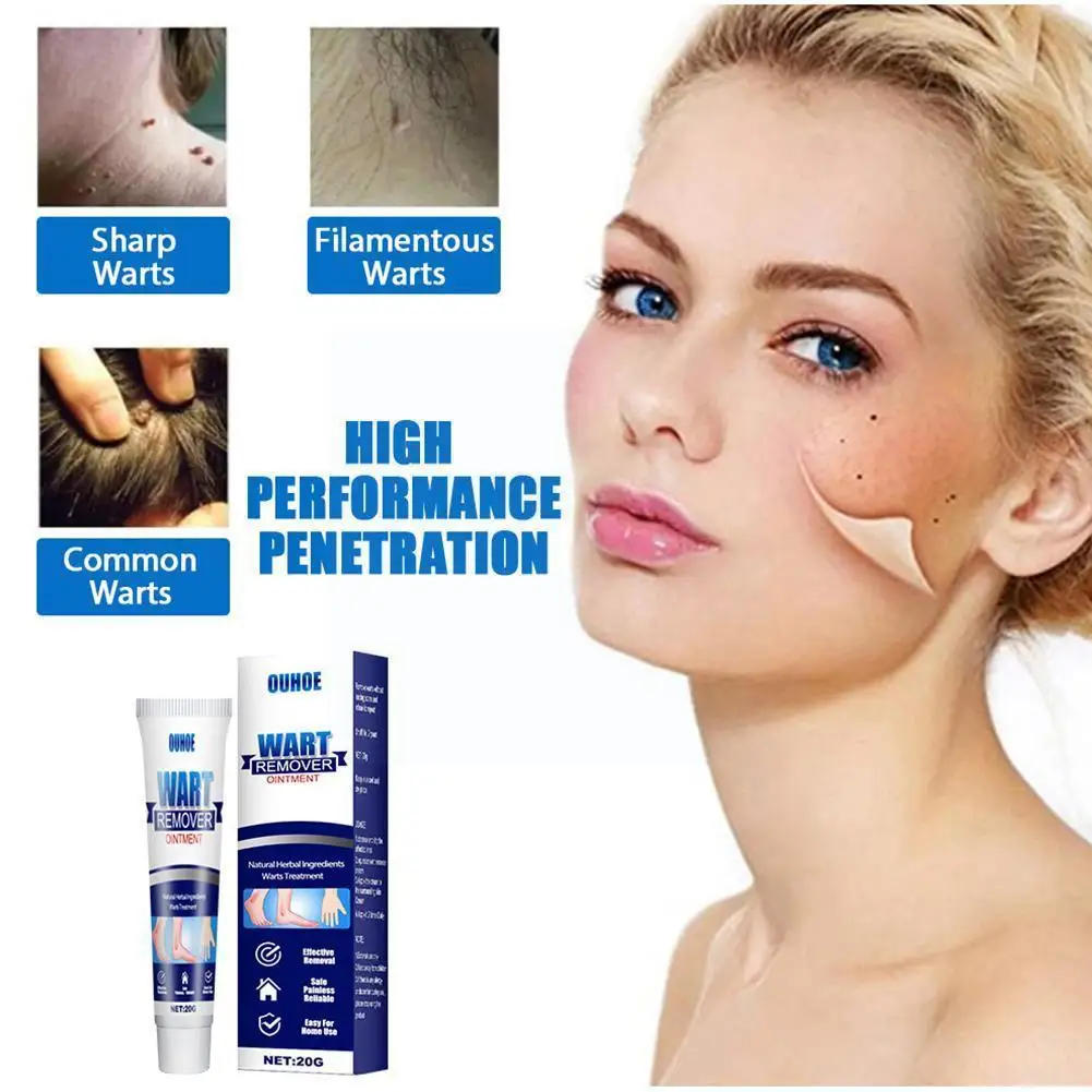 

Wart Removal Cream Antibacterial Ointment Wart Treatment Remover Tag Herbal Skin Corn Plaster Warts Ointment Extract Cream U4i9