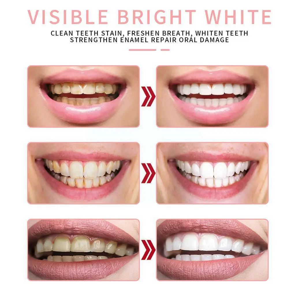 

Toothpaste Stain Removal Whitening Fruit Flavor Toothpaste Gums Fresh Fight Bleeding Teeth Care Health Breath G4Z0