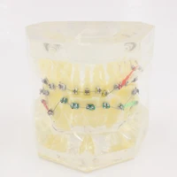 dental model transparent orthodontics treatment model teeth studyteach model