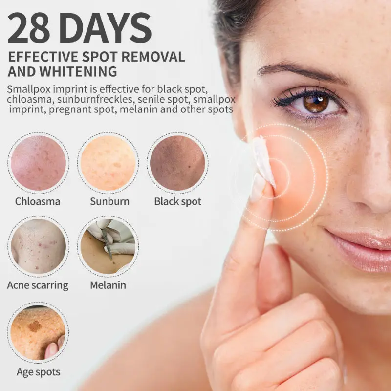 Отбеливающий крем Dimollaure для лица удаления веснушек пятен мелазмы солнечных