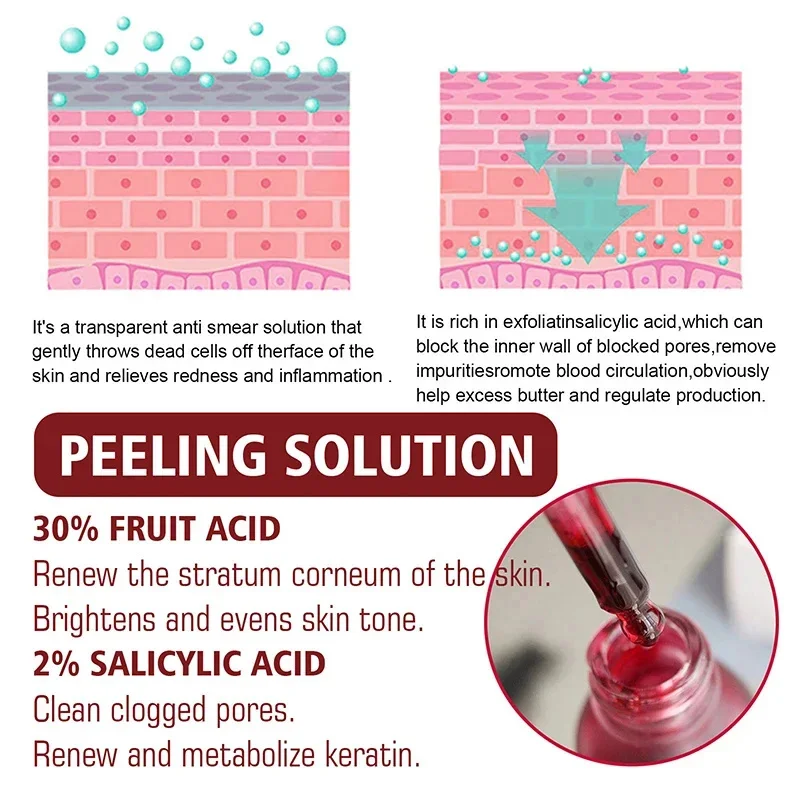 Сыворотка для сужения пор пилинг лица удаление больших подтяжка восстановление