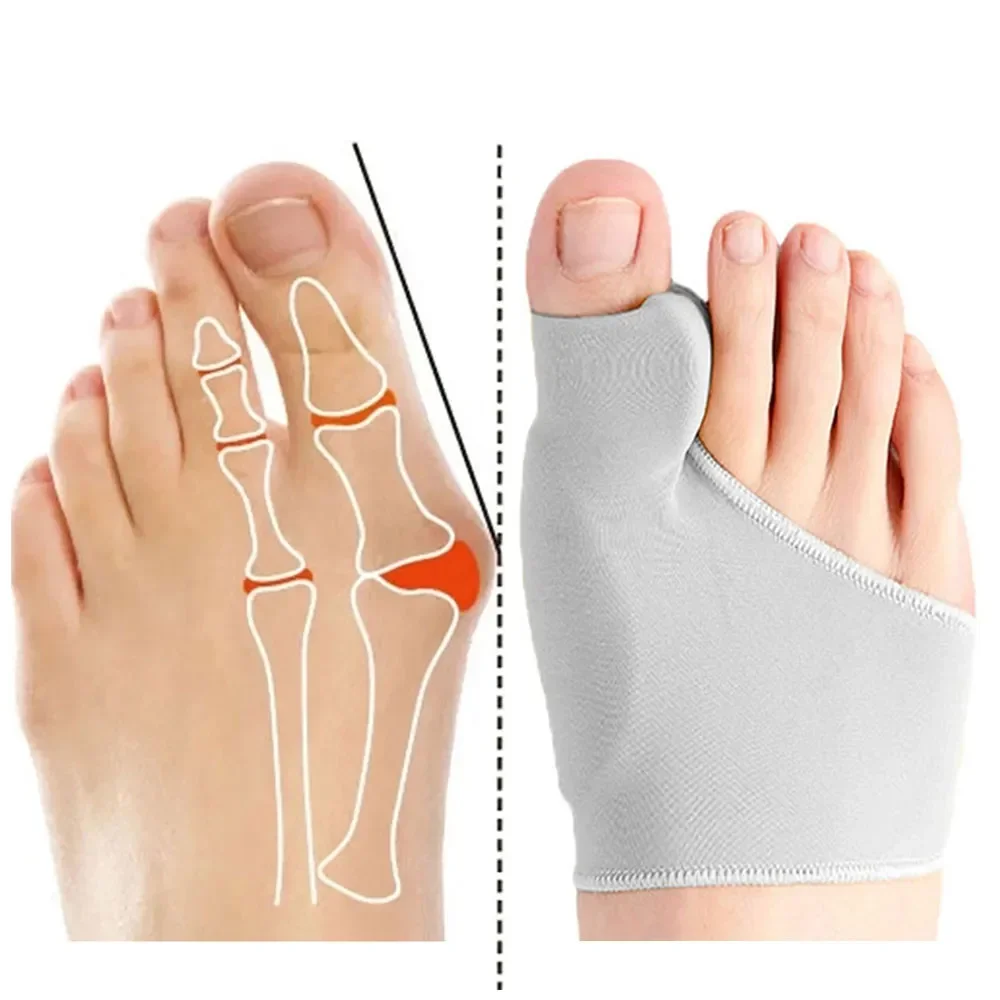 

Fitness Toe Separator Hallux Valgus Bunion Corrector Orthotics Feet Bone Thumb Adjuster Correction Pedicure Sock Straightener