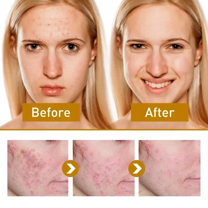 Крем для лица с пятнами и папайей омолаживающий Осветляющий тонизирующий