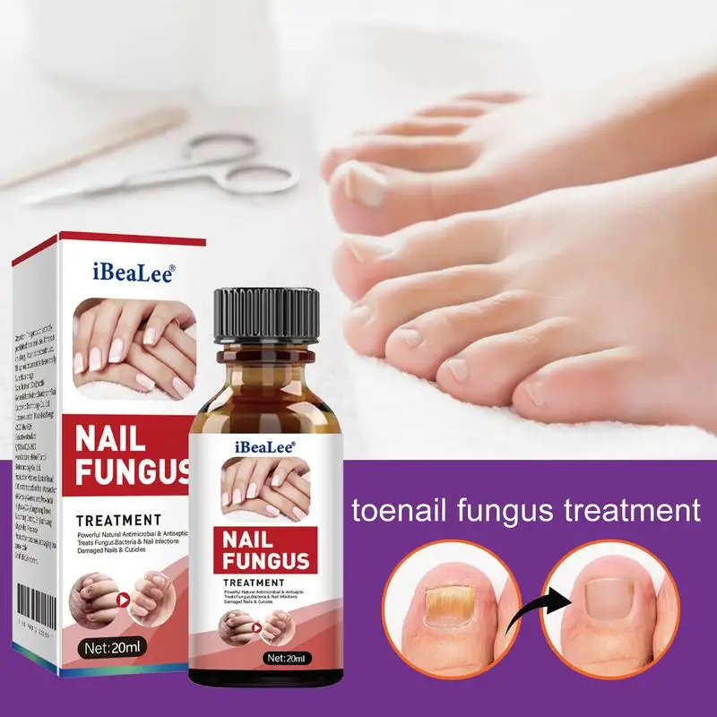

Жидкий растительный экстракт для восстановления ногтей, 20 мл, гель для ногтей, защитный раствор для ногтей, безопасный и эффективный для взрослых женщин и мужчин