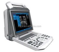 suce i50 12 1 digital ultrasound