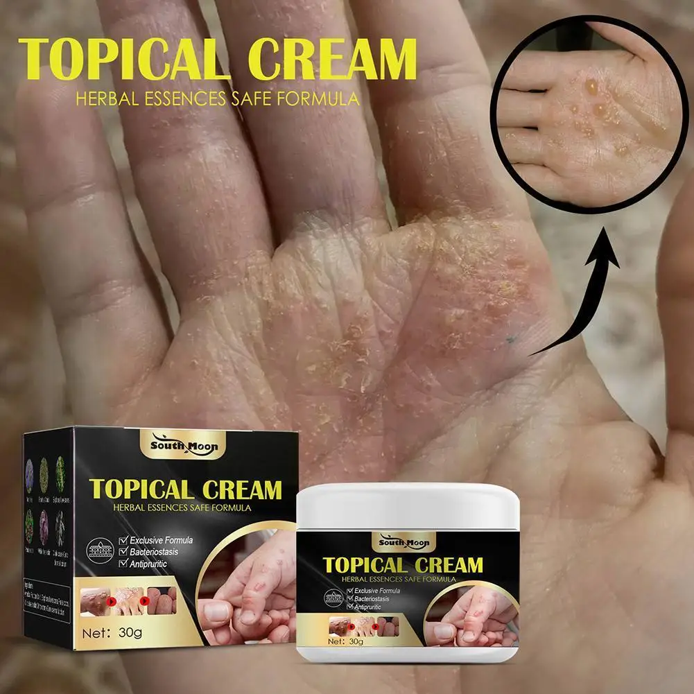 

Антибактериальный крем от зуда для кожи, эффективное лечение детской кожи, экзема, рельефный уход за кожей, Urticar C0U3