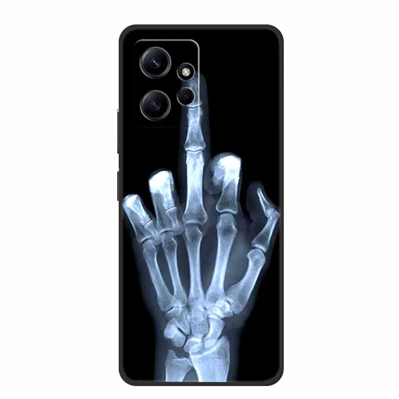 Для Xiaomi Redmi Note 12 4G Чехол Животные Мягкие силиконовые чехлы для телефонов из ТПУ