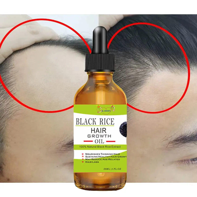 Fast Growing Hair Essential Oil Anti-Hair Loss Serum Hair Regrowth Spray Scalp Treatment Liquid Hair Growth Products Men Women