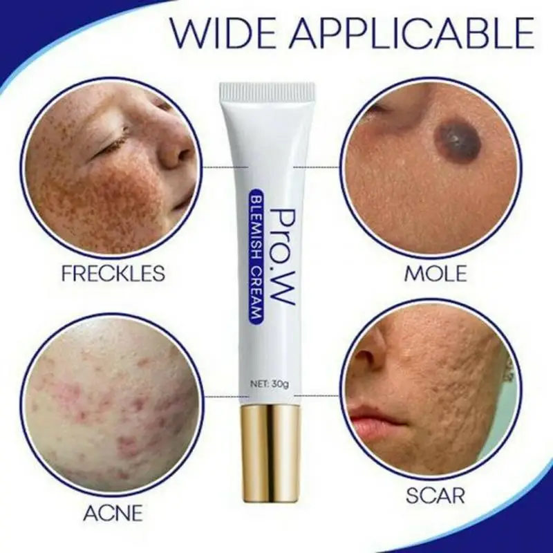 

Face Acne Treatment Blackhead Removal Cream Anti Acne Cream Water-oil Balance Shrink Pores Blemish Cream skin Care