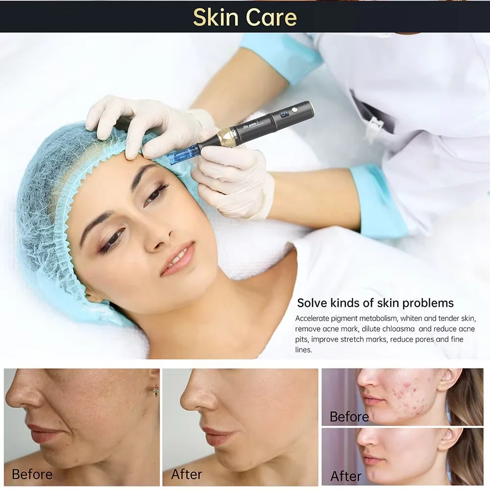 Фото Dr. pen, оригинальная беспроводная ручка Derma Pen A8S, профессиональная ручка для микронидлинга с 30-игольными картриджами, микроигла для ухода за кожей №5