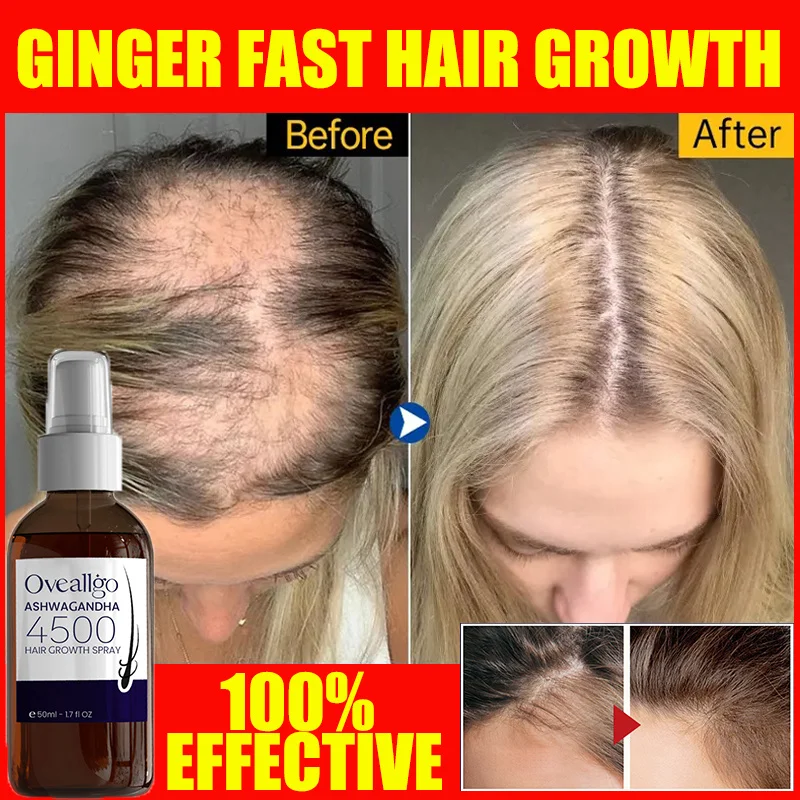 

Ginger Hair Growth Serum Spray Prevent Baldness Scalp Dry Damaged Treatment Anti Hair Loss Men Women Effective Beard Hair Care