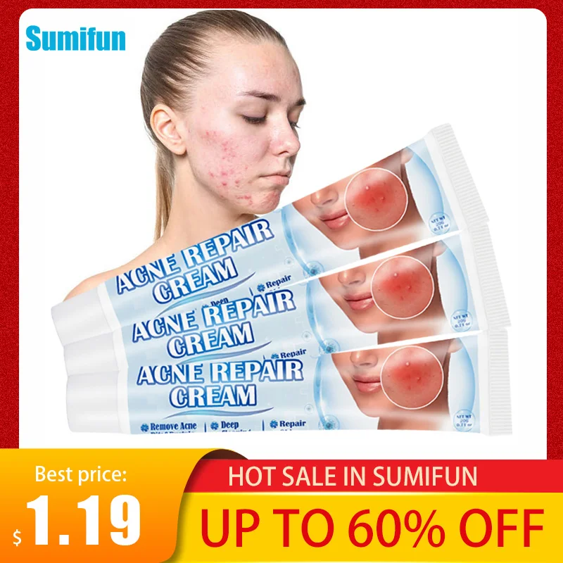 

Sumifun 1Pc Acne Removal Cream Face Deep Cleansing Pimple Pits Pustule Treatment Ointment Herbal Moisturizing Beauty Care