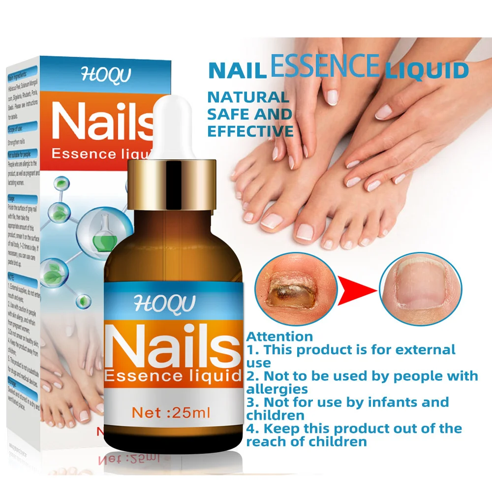 

Эффективная жидкость для ухода за онихомикозом, средство для нежного ухода за ногами, средство для ухода за грибком ногтей, стойкое противогрибковое средство