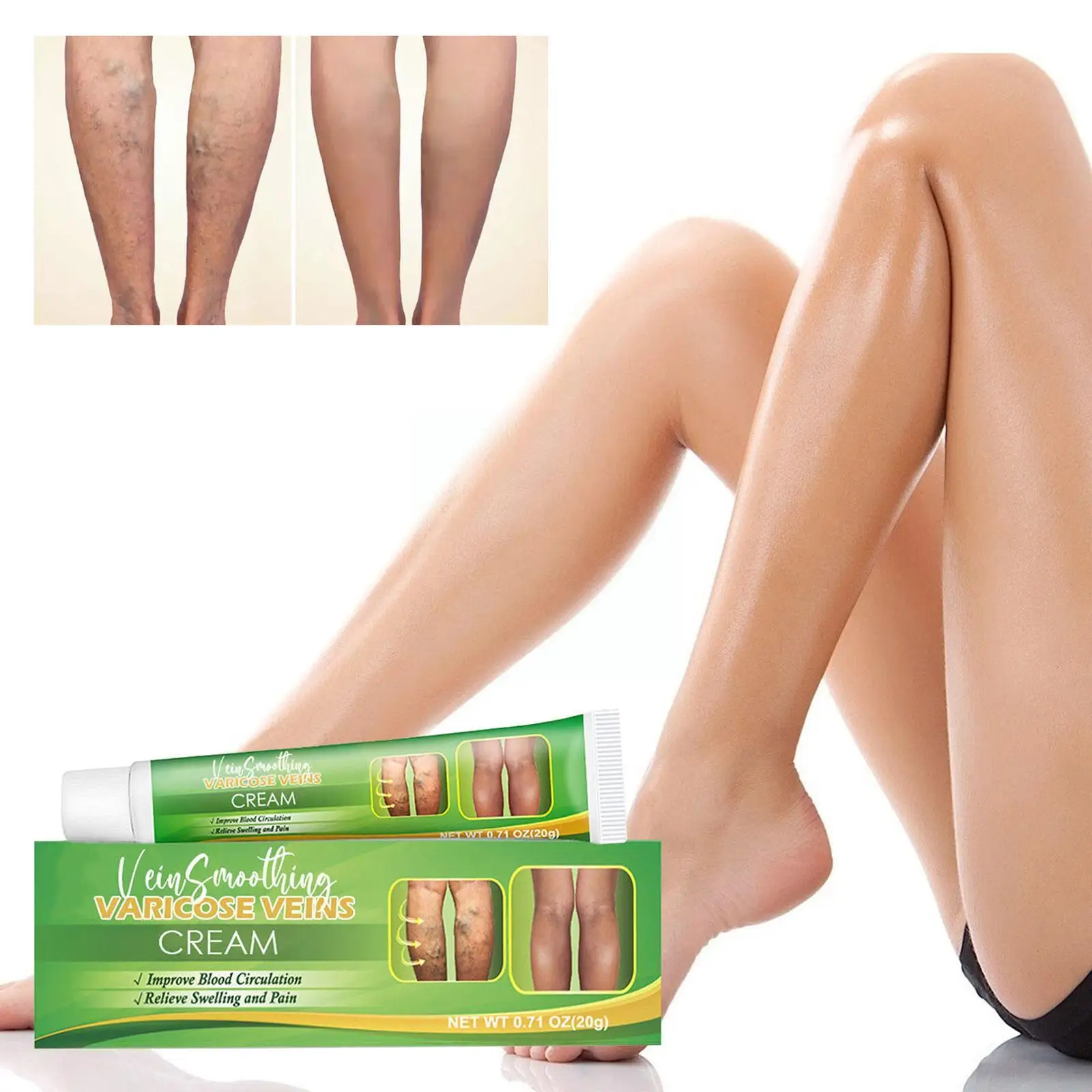 

20g Varicose Vein Cream Repair Swelling Legs Pain Relief Health Beauty Korean Vein Care Products Varicose Remover Skin Crea C7O2