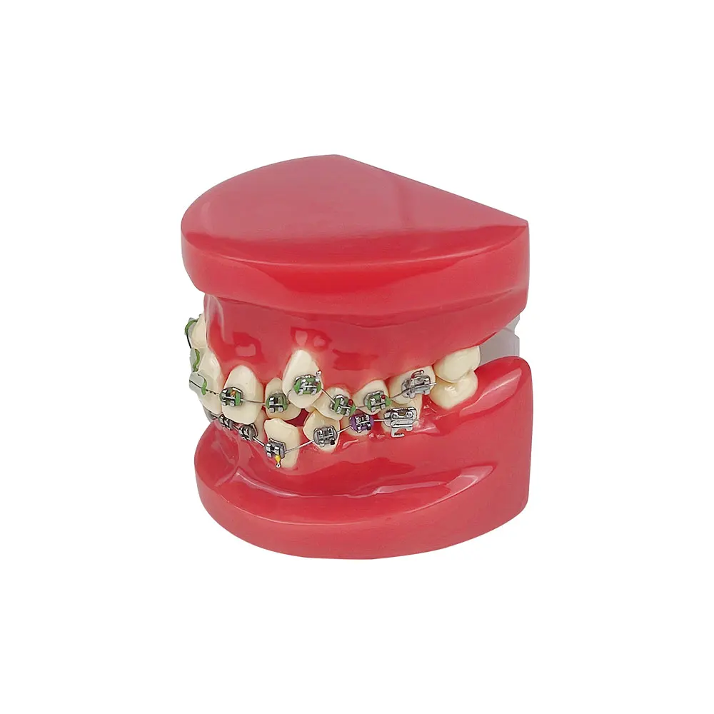 Стоматологическая ортодонтическая модель лечение зубов стандартная обучающая