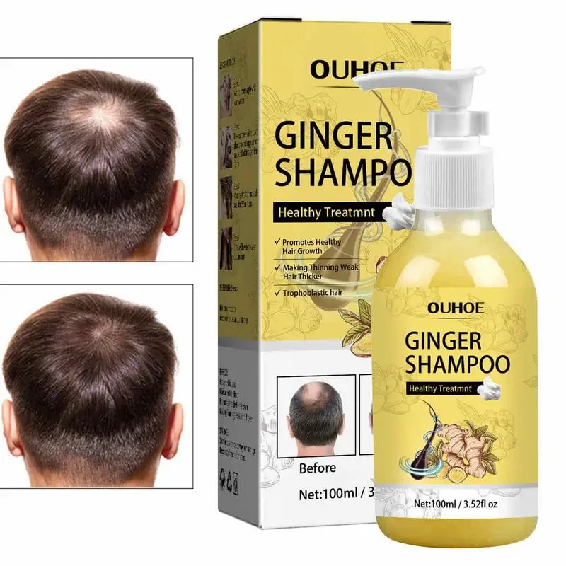 

Pure Ginger Hair Shampoo Hair Growth Deep Anti Hair Refreshing Scalp Softening Nourishing Hair Loss Care