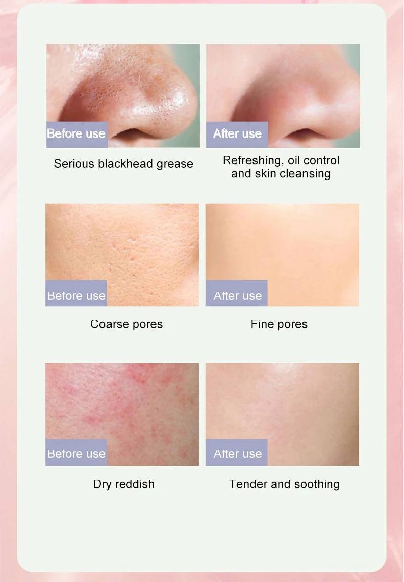 Маска из бамбукового угля для глубокой очистки увлажняющая |