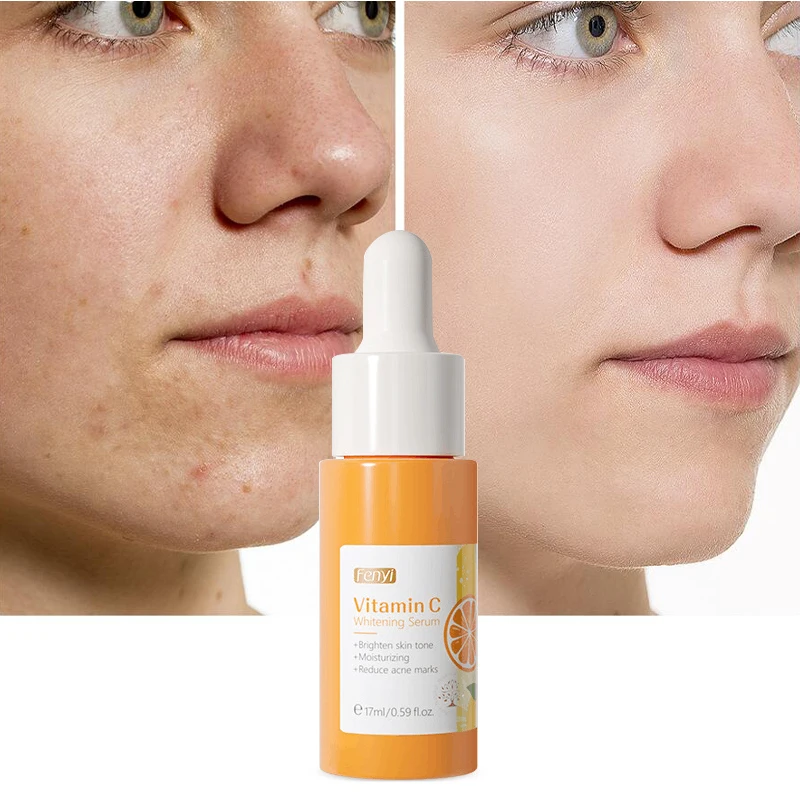 

Vitamin C Whitening Face Serum Reduce Acne Marks Fade Fine Lines Dark Spots Melanin Moisturizer Brighten Beauty Korean Cosmetics