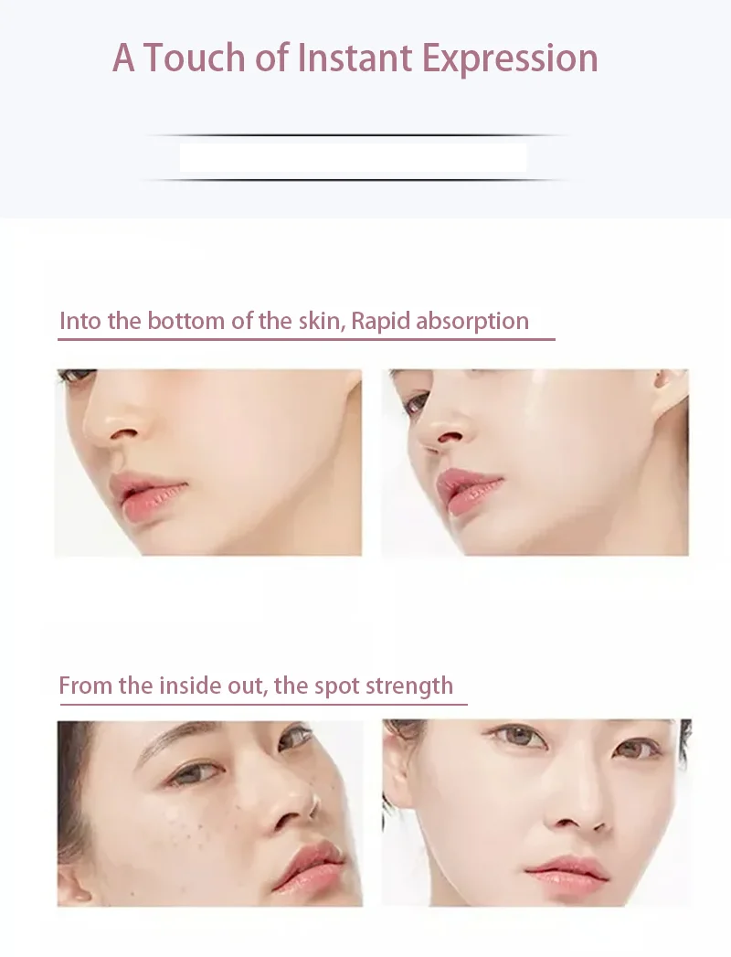 Aberden Facial Serum Freckle Removing Essence Whitening Cream Highlighter Skincare Brighten Skin Moisturizing Wrinkle Face |