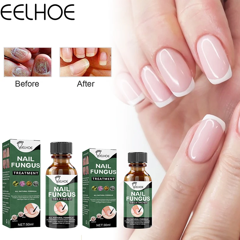 

eelhoe Grey Nail Repair Solution Thickening Brightening Soft Nail Solution Foot Care Solution Grey Nail Enhancement Solution