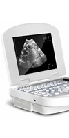 yd 3w 2200 black and white b ultrasound portable b ultrasound diagnostic instrument small digital b ultrasound black and white u