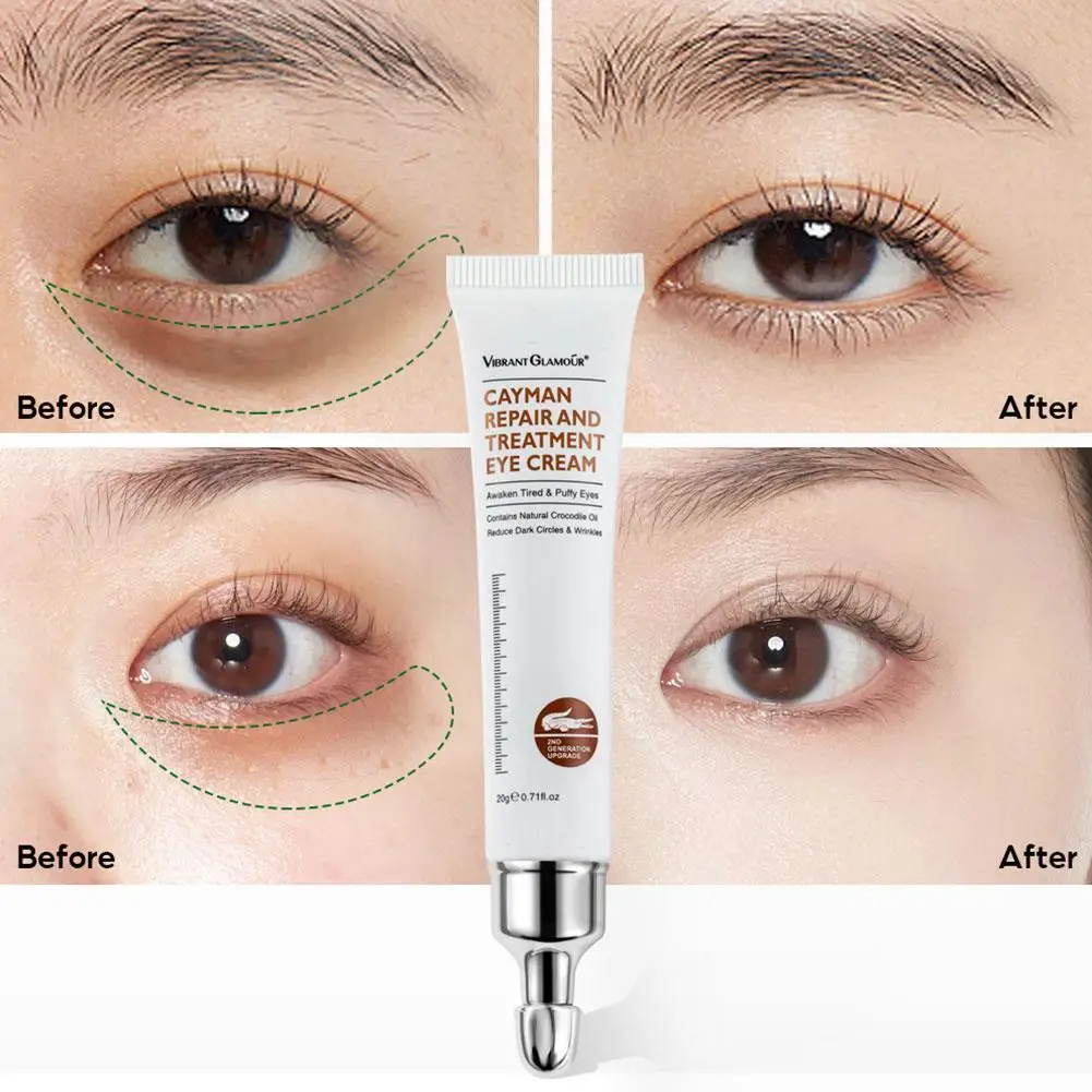 

Women Anti-wrinkle Eye Serum Hyaluronic Acid Remover Dark Circles Eye Cream Crocodile Against Puffiness Essence 20g