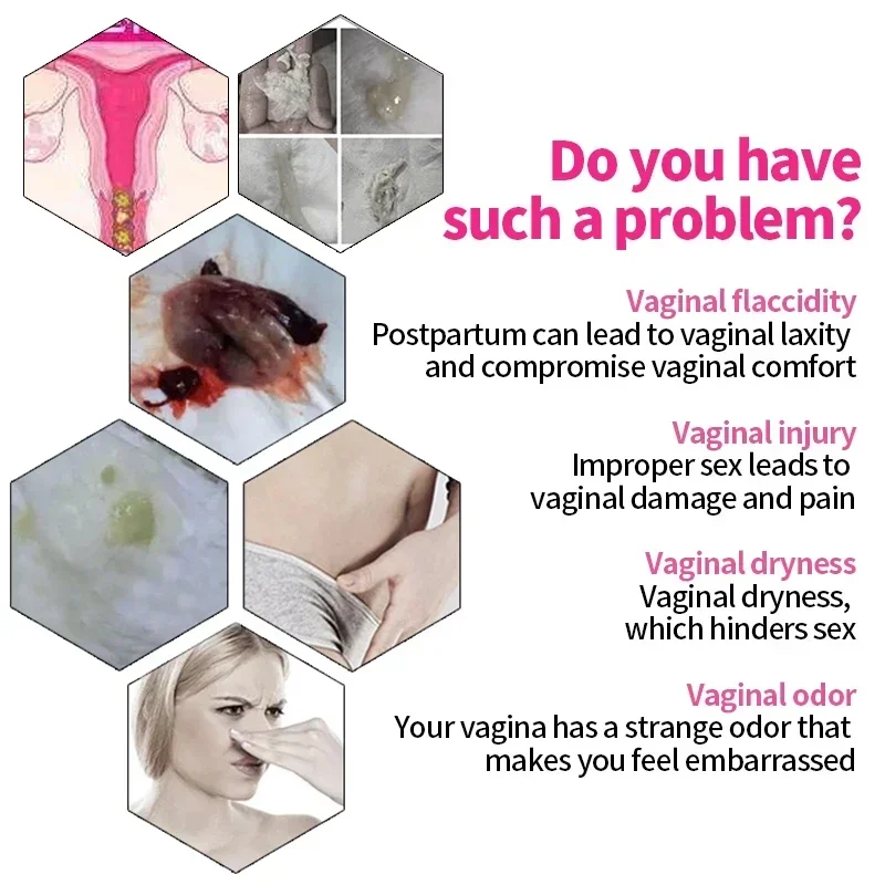 Супозиторий для подтяжки влагалища вагинальная подтяжка лечение расплава