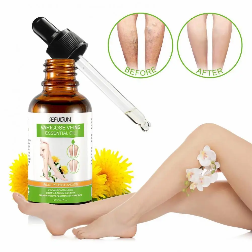 

30ml Varicose Oil Universal Deeply Penetrating Non-Irritating for Home Use Veins Oil Varicose Vein Oil