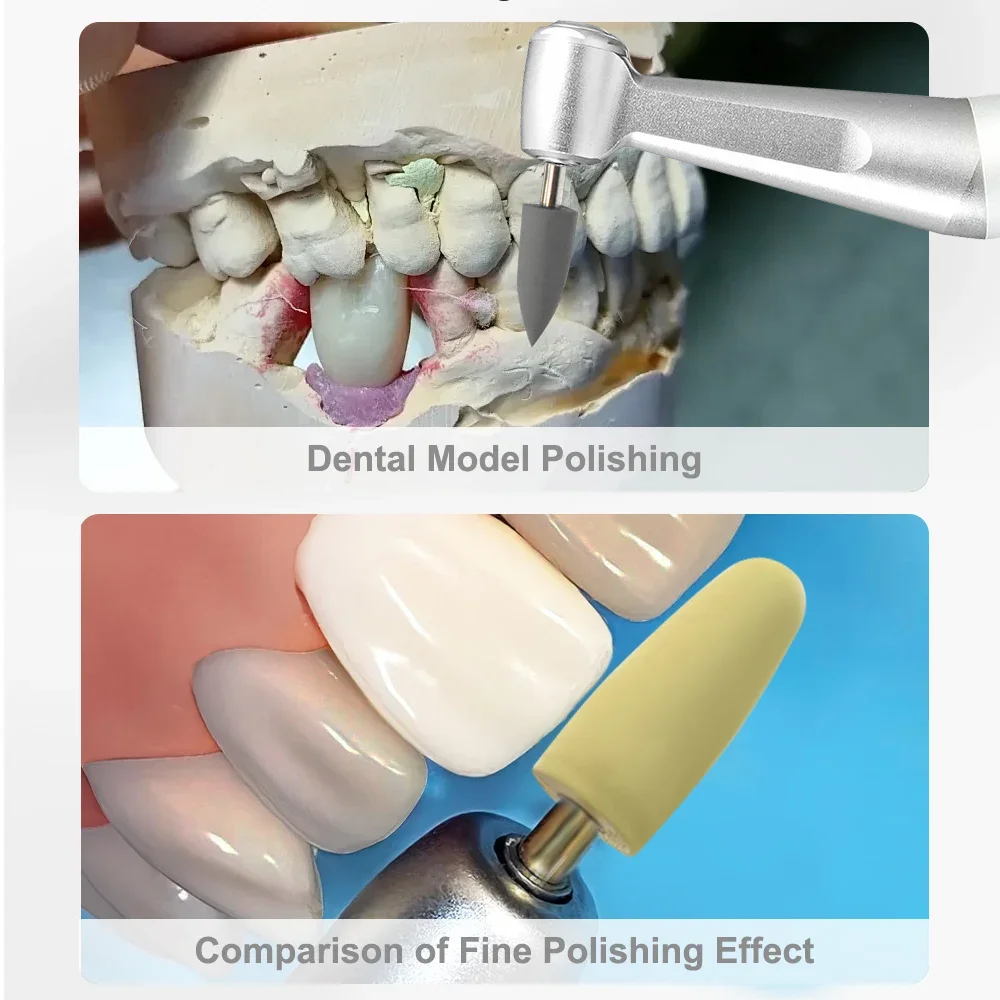 HP0412 12 шт./компл. стоматологическая полимерная основа наборы для полировки