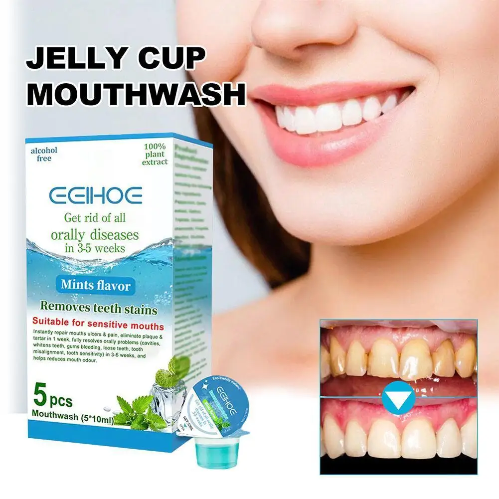

Jelly Cup Mouthwash Disposable Mouthwash Will Carry Breath Bucal Mouthfeel Wash Mouth Mild Flavors A Enjuague of Variety Fr F4E9