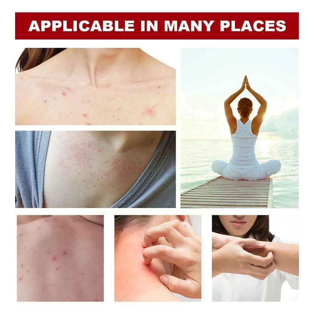 

Hair Follicle Net Spray To Suppress Hair Follicle Growth Itching Spray And Back Itching Redness Chest Y9x3