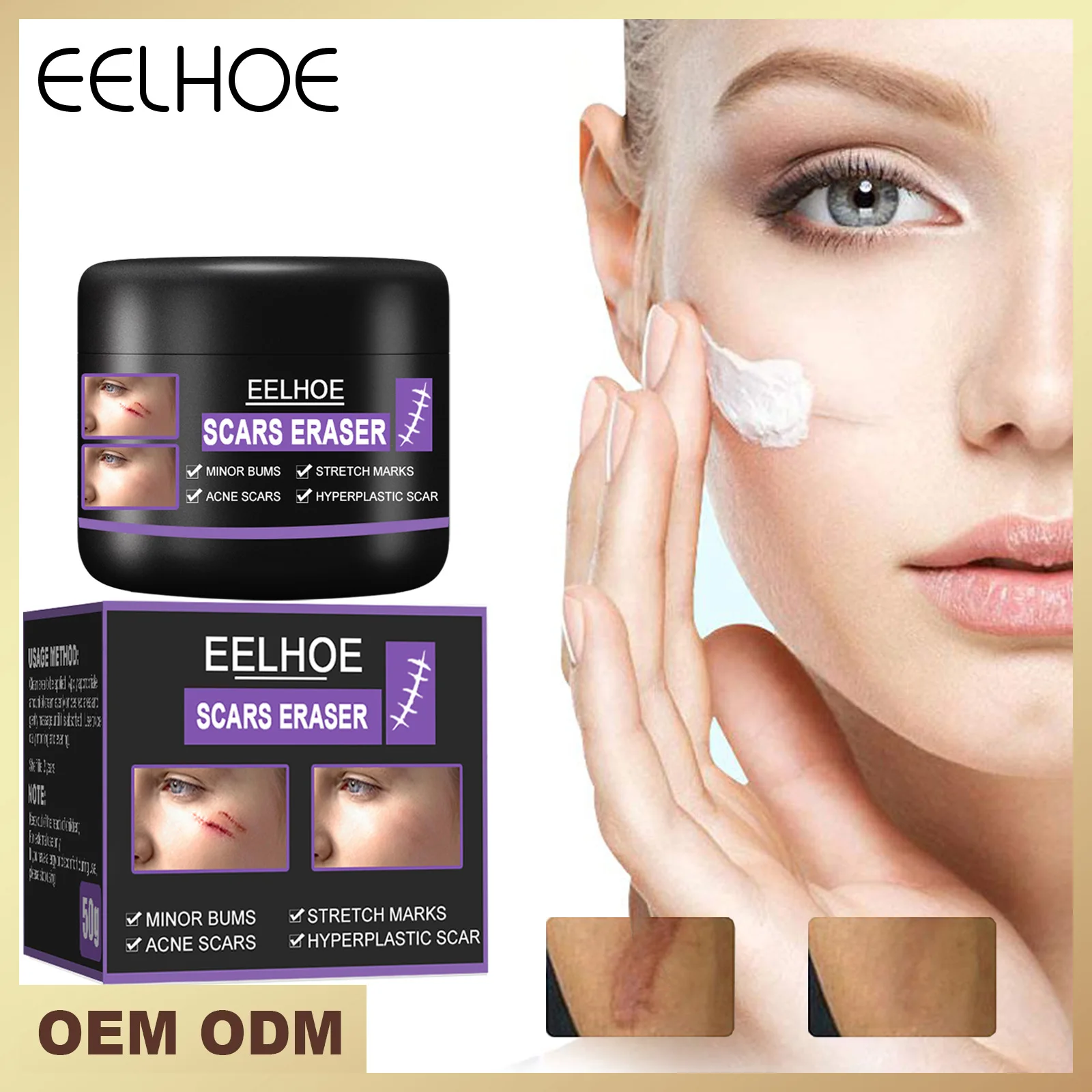 

Eelhoe Scar Removal Cream Desalination Scald Burn Old Scar Pox Pit Mark Operation Scar Smoothing Skin Scar Repair Cream 50g