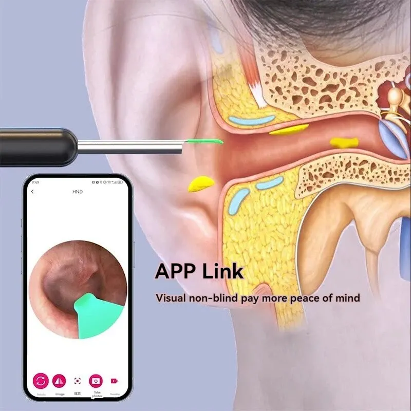 Беспроводное решение для ухода за ушами BeeChip с отоскопом освещением 1296P HD