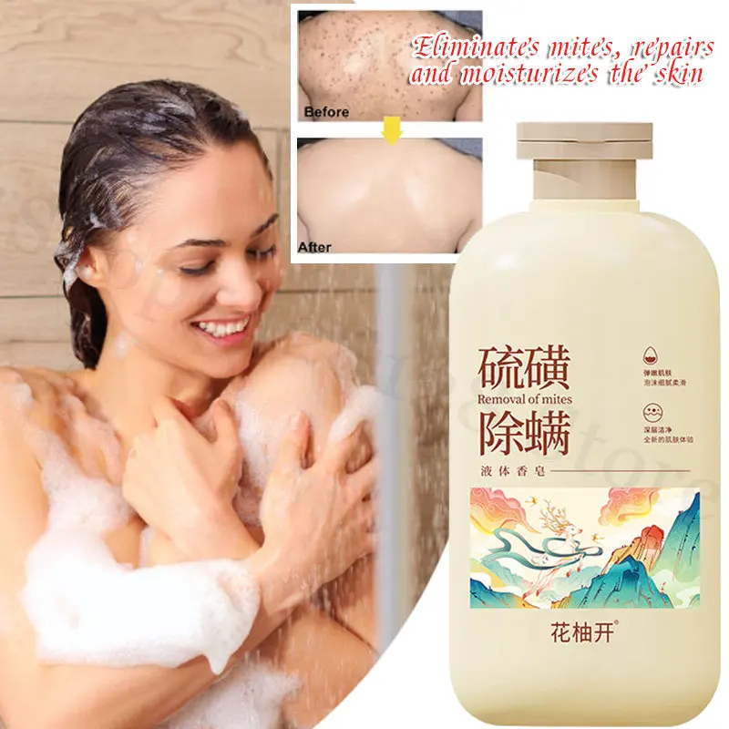 

Sulfur Mite Removal Solution Relieves Dry Skin Controls Oil Relieves Itching Moisturizes and Softens Skin Cleans Dirt Body Wash