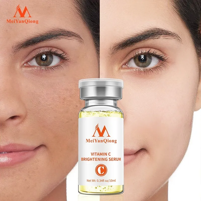 

Vitamin C whitening Essence Removes Yellow Spots Brightens Skin Whitens Tone Moisturizes Deep Rejuvenates Nourishes Skin