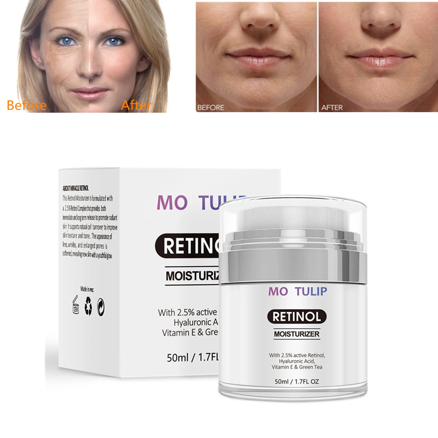 

2.5% Retinol Moisturizing Cream Anti Aging and Reduces Wrinkles and Fine Lines Day and Night Retinol Cream Skincare Moisturizer