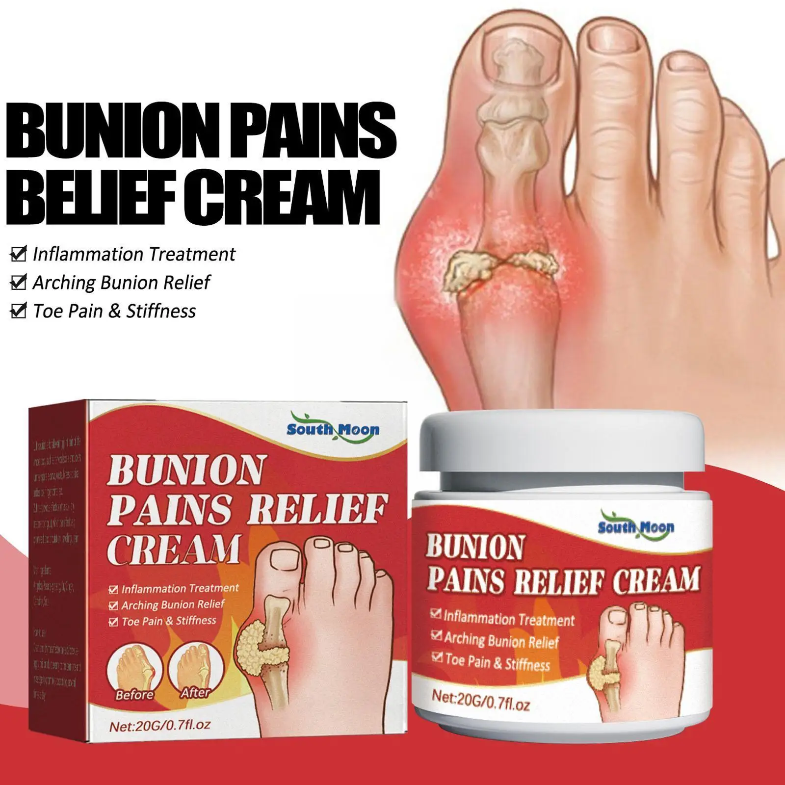 

20g Gout Treatment Ointment Toe Joint Valgus Corrector Cream Thumb Hallux Finger Arthritis Pain Relief Medical Plaster for G2S4