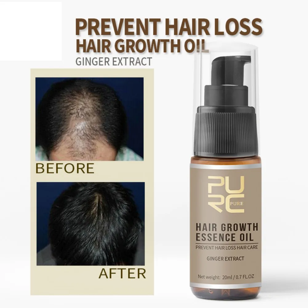 

Натуральное травяное лечение против выпадения волос REDDHOON делает рост волос длиннее и толще, средство для ухода за волосами