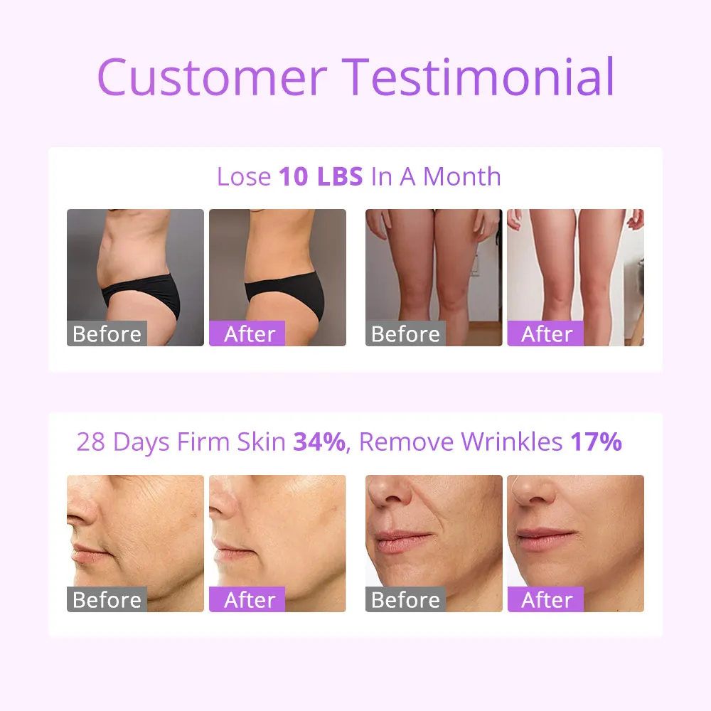 Aristorm S Shape Machine 30K Ультразвуковая форма тела Лифтинг лица бытовой прибор для