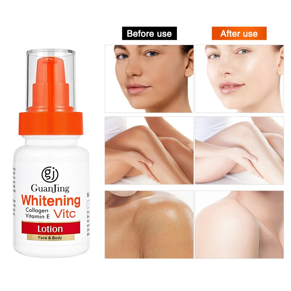 

Whitening Cream Whiten Butt Knee Brighten Inner Thigh Dark Remove Melanin Private Parts Underarm Intimate Area Bleaching Serum