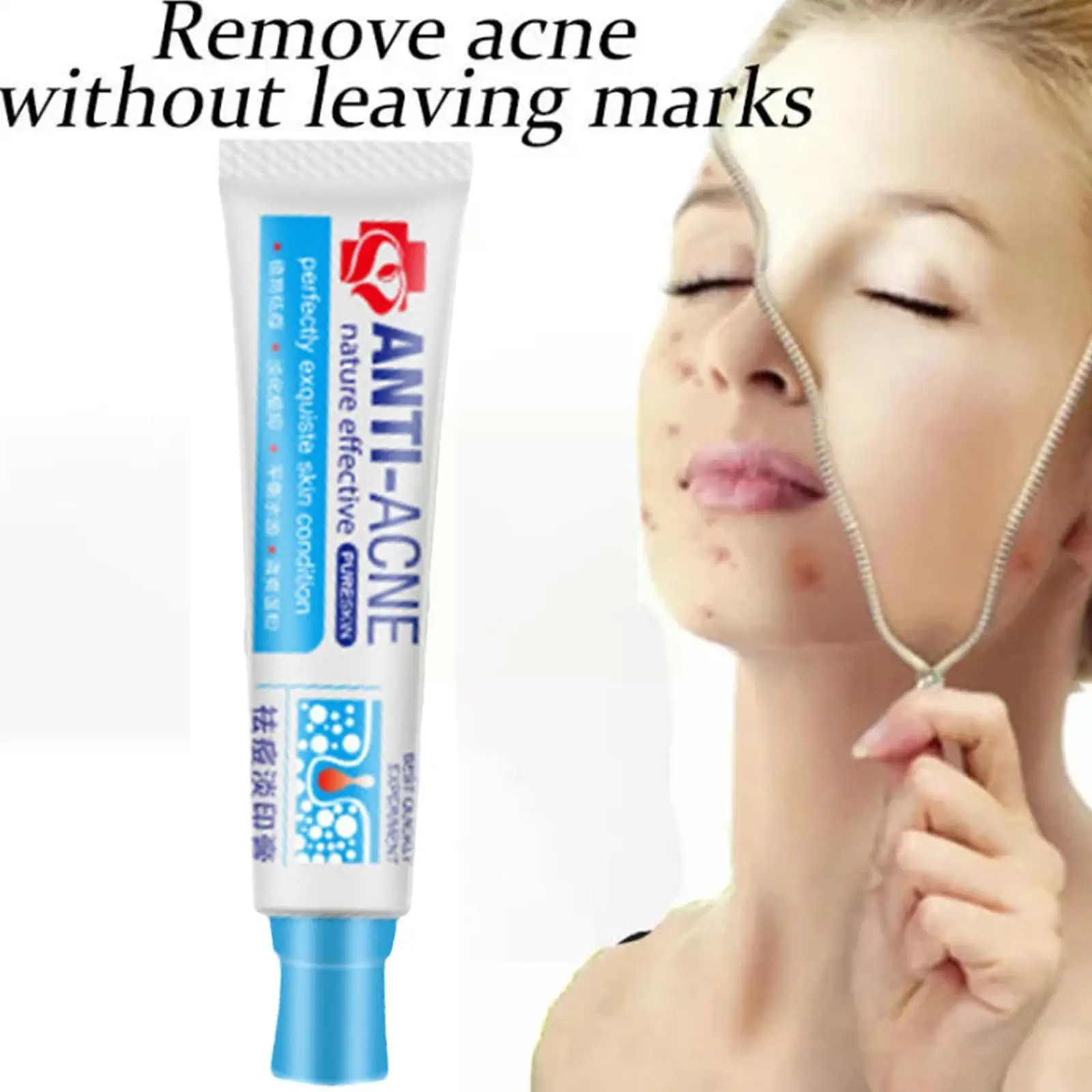

30g Effective Acne Removal Cream Remove Melasma Fade Spots Moisturizing Whitening Shrink Freckle Oil Pores Control Cream Ac I0W2
