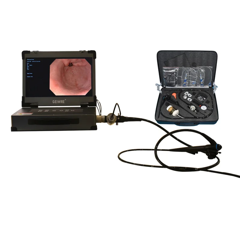 

Video Endoscopy Equipment Gastroscope and Colonoscope System
