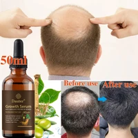 2022 latest hair regeneration essence moisturizes and softens the scalp repairs damaged hair and prevents hair loss