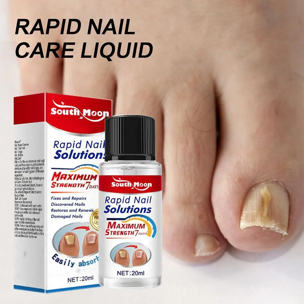 

Nail Fungal Treatment Serum Anti Infection Onychomycosis Paronychia Rapid Repair Gel Toe Nail Fungal Fast Removal Hand Foot Care