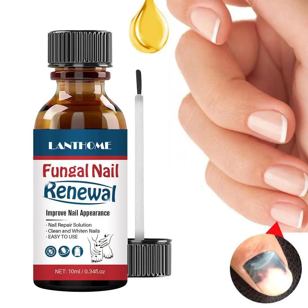 

10ml Nail Repair Essence Serum Fungal Nail Treatment Remove Onychomycosis Toe Nourishing Brighten Hand Foot Skin Care