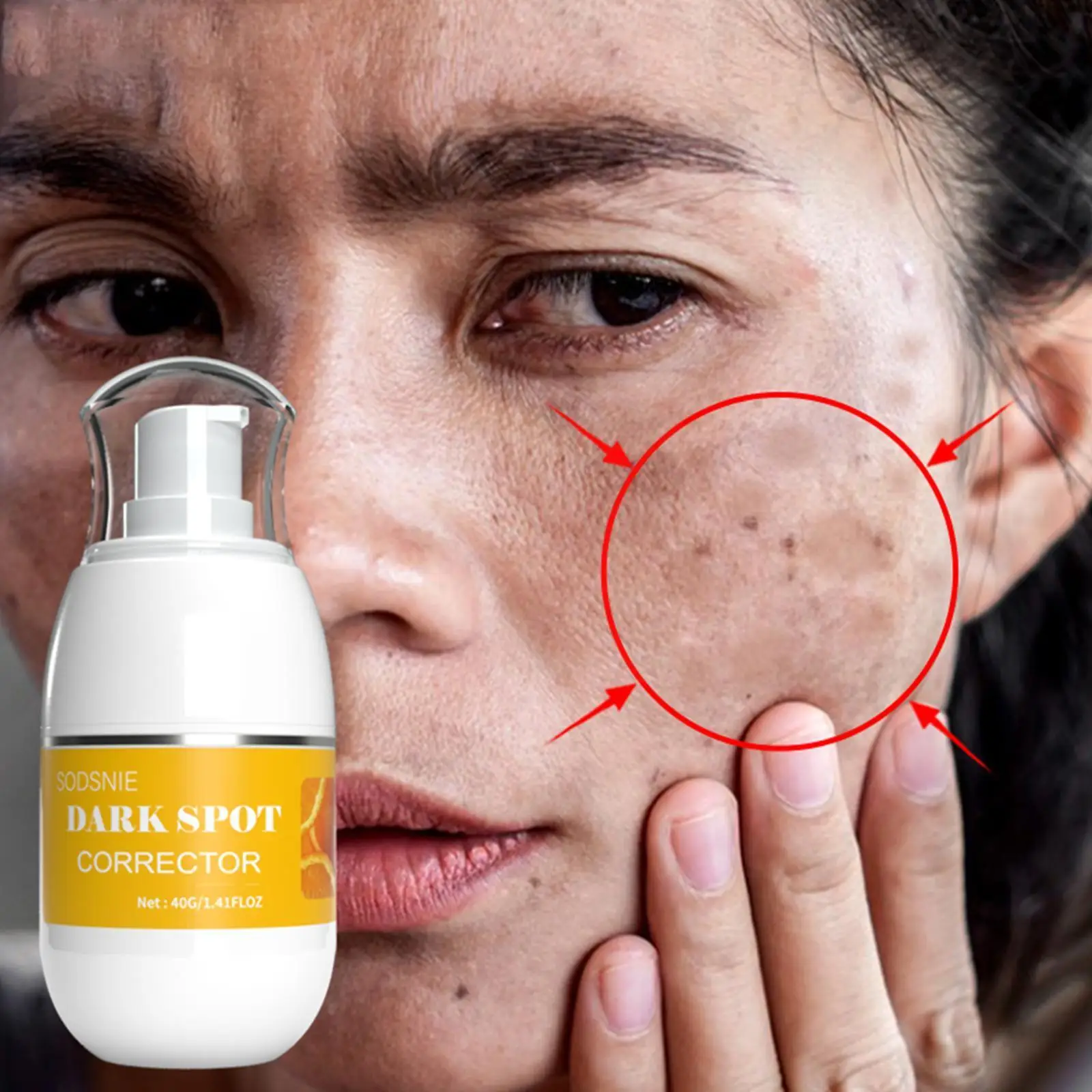 

Dark Spot Corrector Moisturizing Effectively Removes Age Spots Brightening Dark Spots Care Chloasma Spots Whitening Ski W4a2