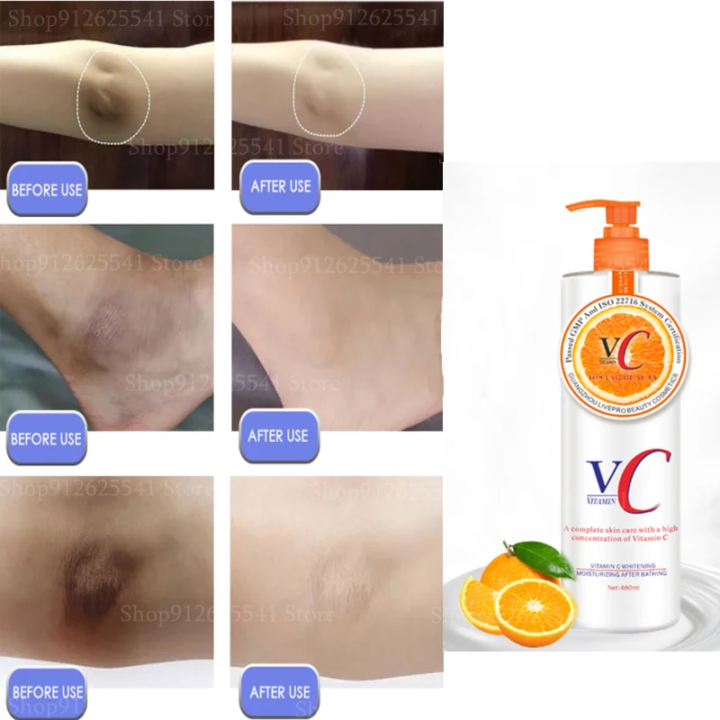 

Vitamin VC Body Milk Lotion Whitening Cream Moisturizing Repair Improve Arm Armpit Ankles Elbow Knee Body Dull Brighten Arbutin