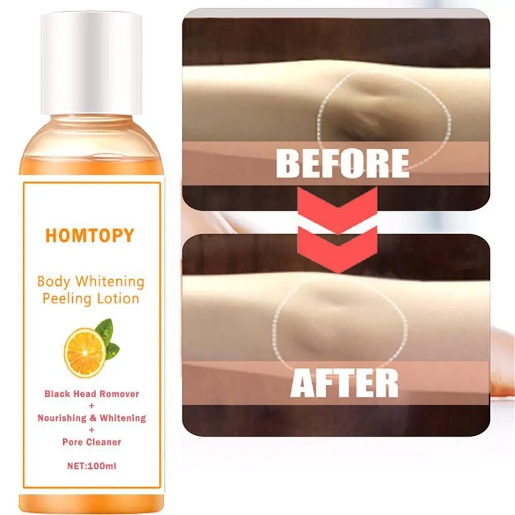 

100ml Orange Peeling Oil Knuckles Whitening Effective For Remove Dead Skin Exfoliating New Skin Care Anti Dark Spots Oil J9v1