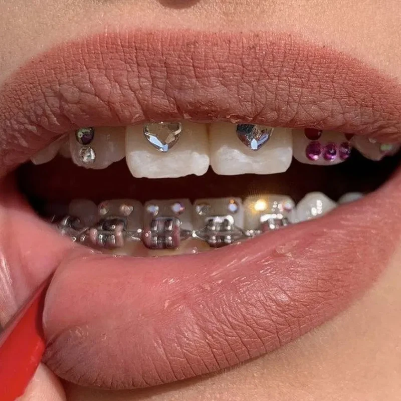 NEW Teeth Decorations 37% Acid Etching Gel Light Cure Adhesive Flowable Composite Professional Diy Crystal Jewelry Tooth Gem Kit