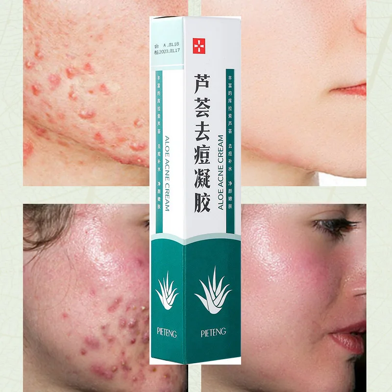 

1 шт., отбеливающий увлажняющий гель для лица с экстрактом алоэ вера, 30 г